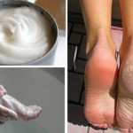 Voici comment faire une pédicure à la maison avec du bicarbonate de soude