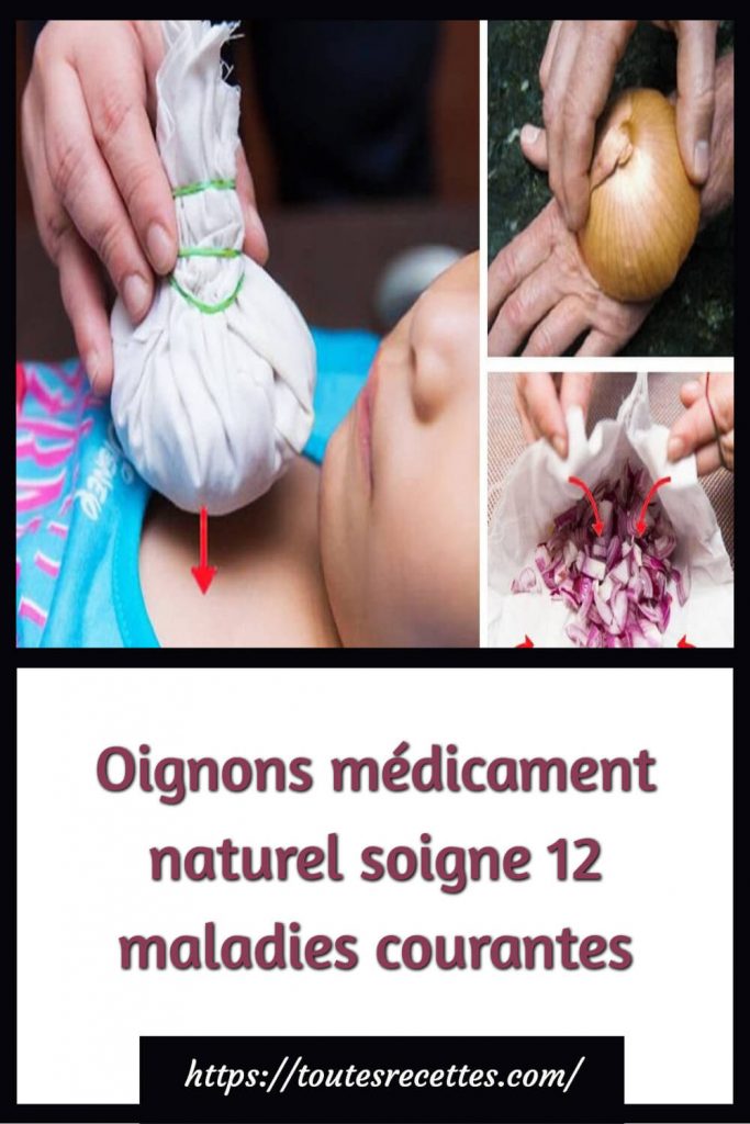 Oignons médicament naturel soigne 12 maladies courantes