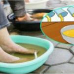 Le vinaigre de cidre de pomme, une merveille pour les pieds