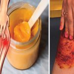 Recette au piment et huile d’olive pour les genoux et les articulations