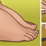5 problèmes de santé à l’origine des chevilles gonflées, comment les guérir