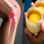 Douleur aux genoux et articulations Voici comment soulager