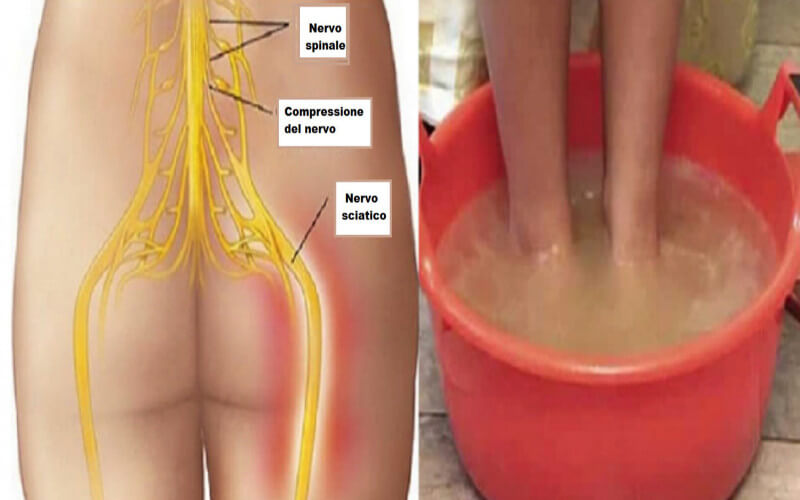 Méthode naturelle pour soulager la douleur du nerf sciatique