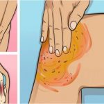 Recette pour soulage les douleurs du genou, des os et des articulations