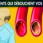 14 aliments qui nettoient vos artères et les garder saines