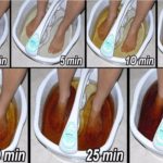 Comment éliminer les toxines accumulées à travers les pieds