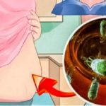 Ballonnements, gaz ou constipation, l’origine de vos problèmes digestifs !