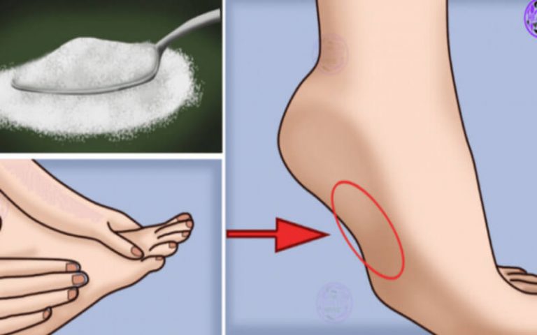 7 signes que vous mangez trop de sucre