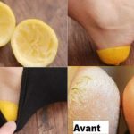 Astuce efficace pour se débarrasser de talons laids et gercés