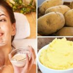 Éliminer les taches sur le visage avec les pommes de terre